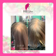 Load image into Gallery viewer, balding growth oil, hair growth oil, hair growth tips, hair growth products, veganhair care, all natural products, natural products, mega hair growth