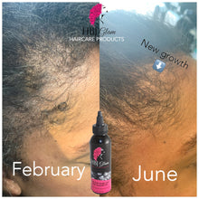 Load image into Gallery viewer, Anti- Itch & Growth Oil
