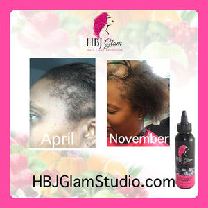 Anti- Itch & Growth Oil